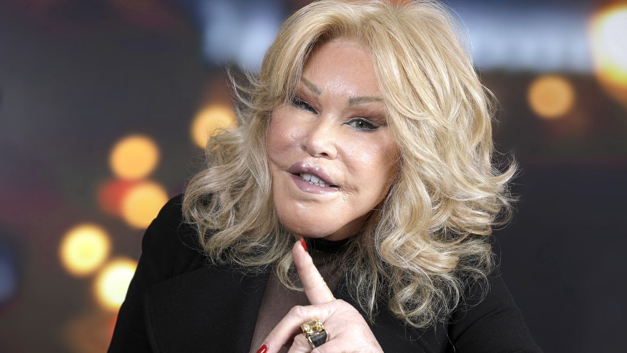 Fallece Jocelyn Wildenstein, conocida como «Catwoman» por sus cirugías plásticas extremas Fallece Jocelyn Wildenstein, conocida como «Catwoman» por sus cirugías plásticas extremas