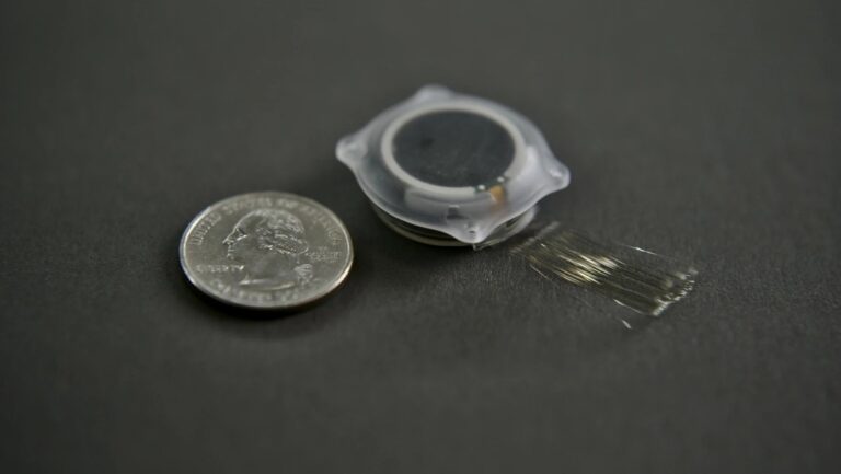 Neuralink implantó un chip cerebral a tercer paciente